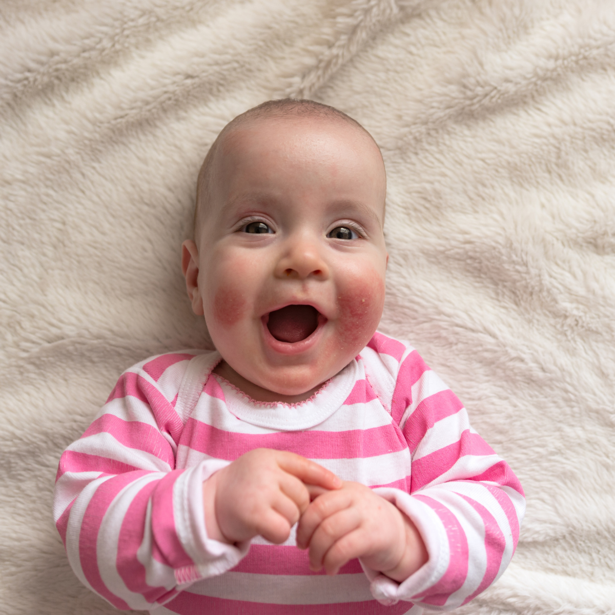 Neurodermitis bei Babys und Kindern vorbeugen