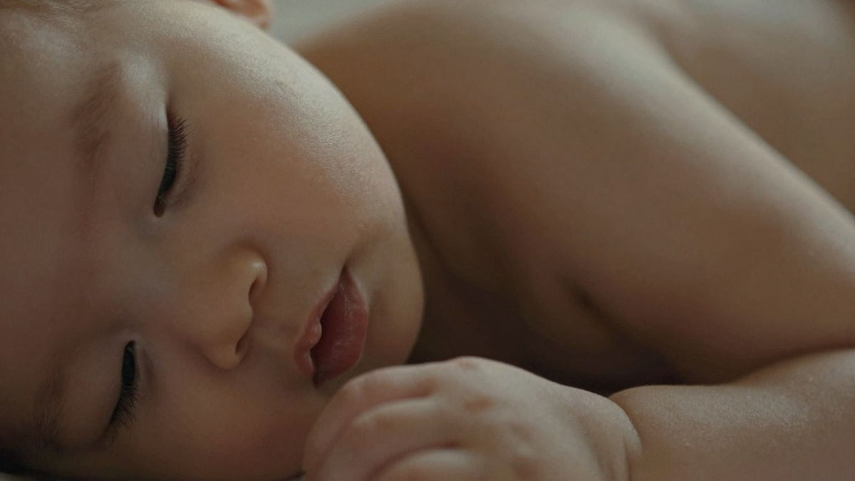 Babyhaut mit trockenen Stellen
