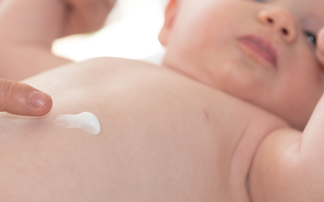 Normale Haut, trockene Haut oder Neurodermitis? Babypflege erklärt